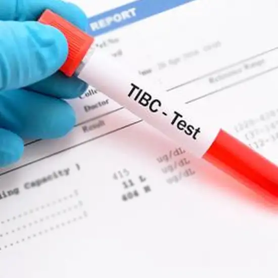 total iron binding capacity (tibc) test
